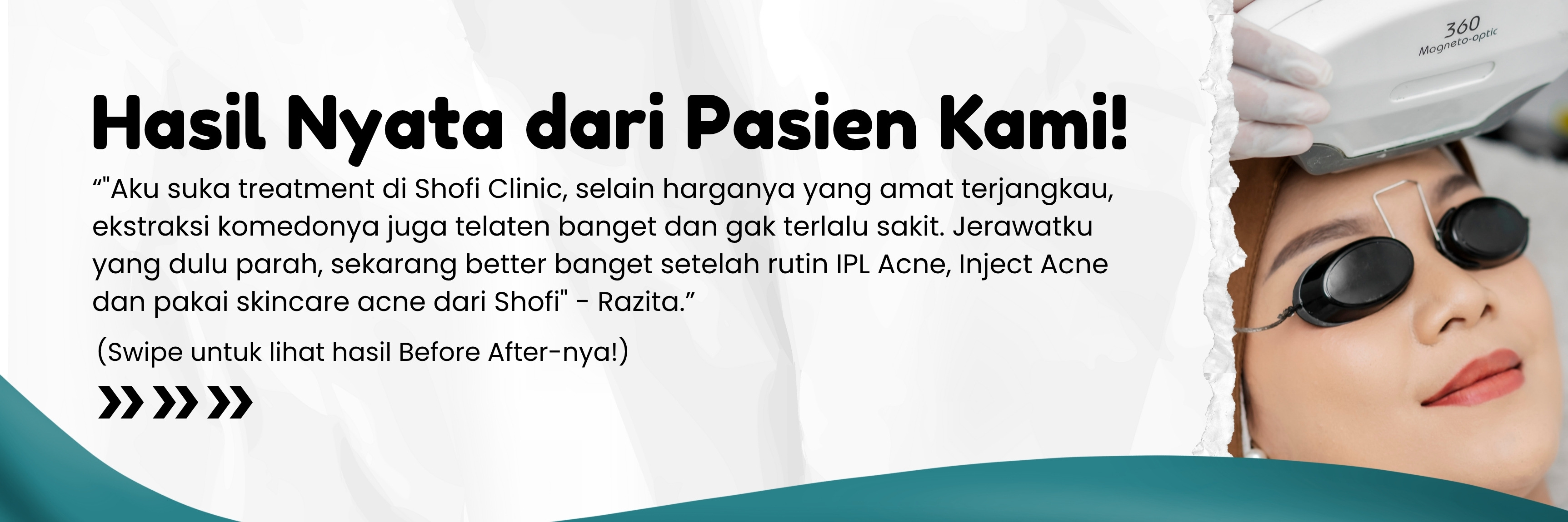 Honest Testimoni Treatment dari Shoties!