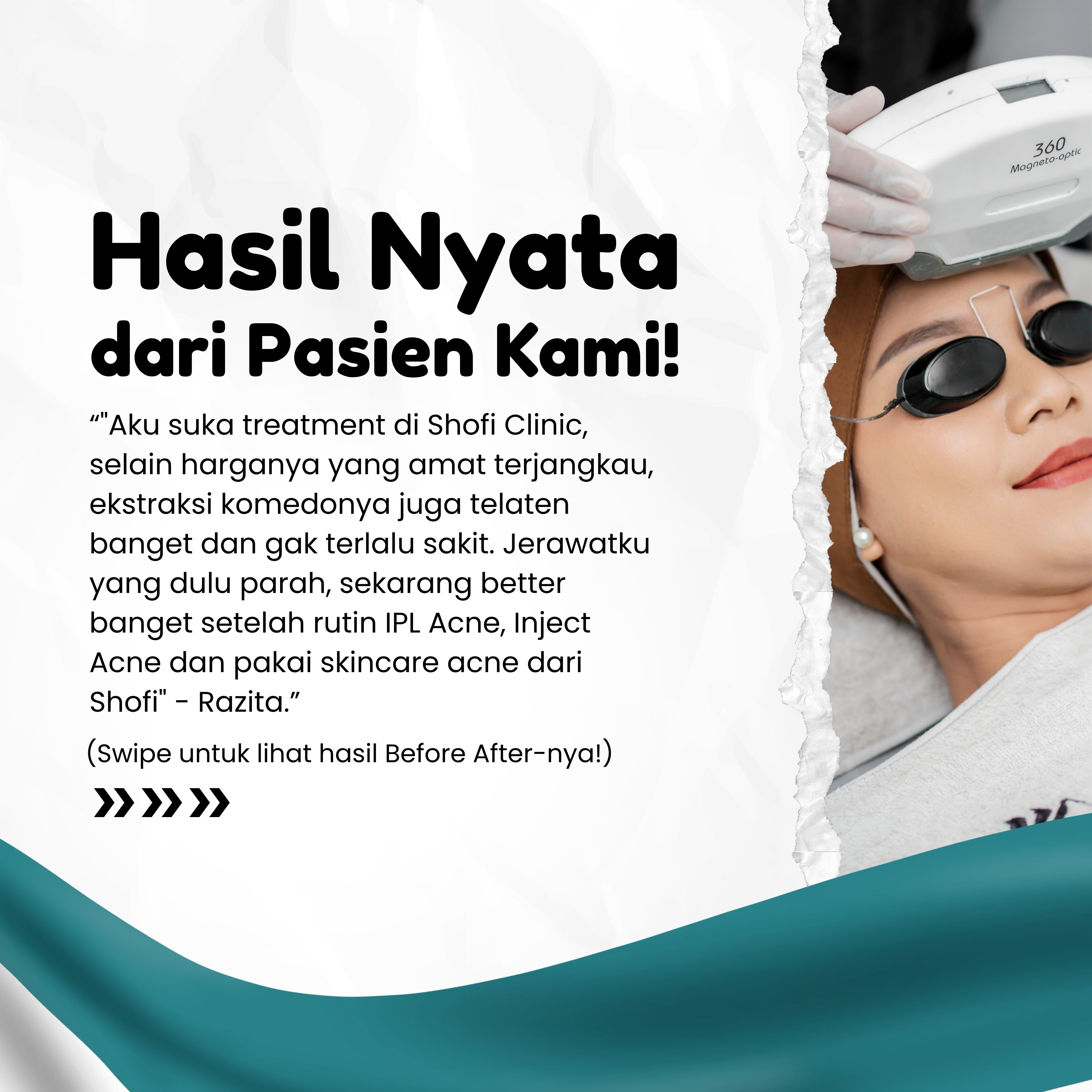 Honest Testimoni Treatment dari Shoties!