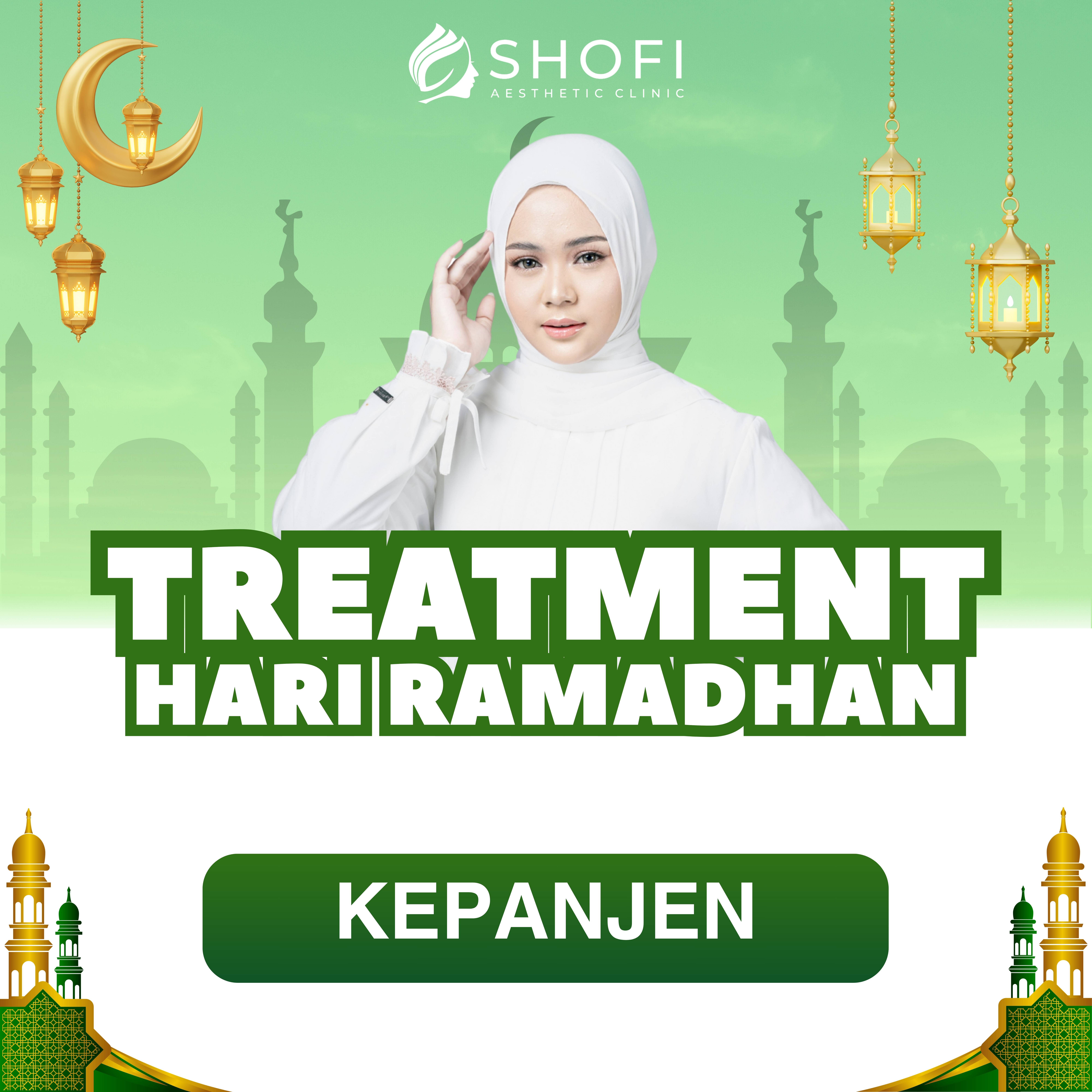 PROMO MARET KEPANJEN