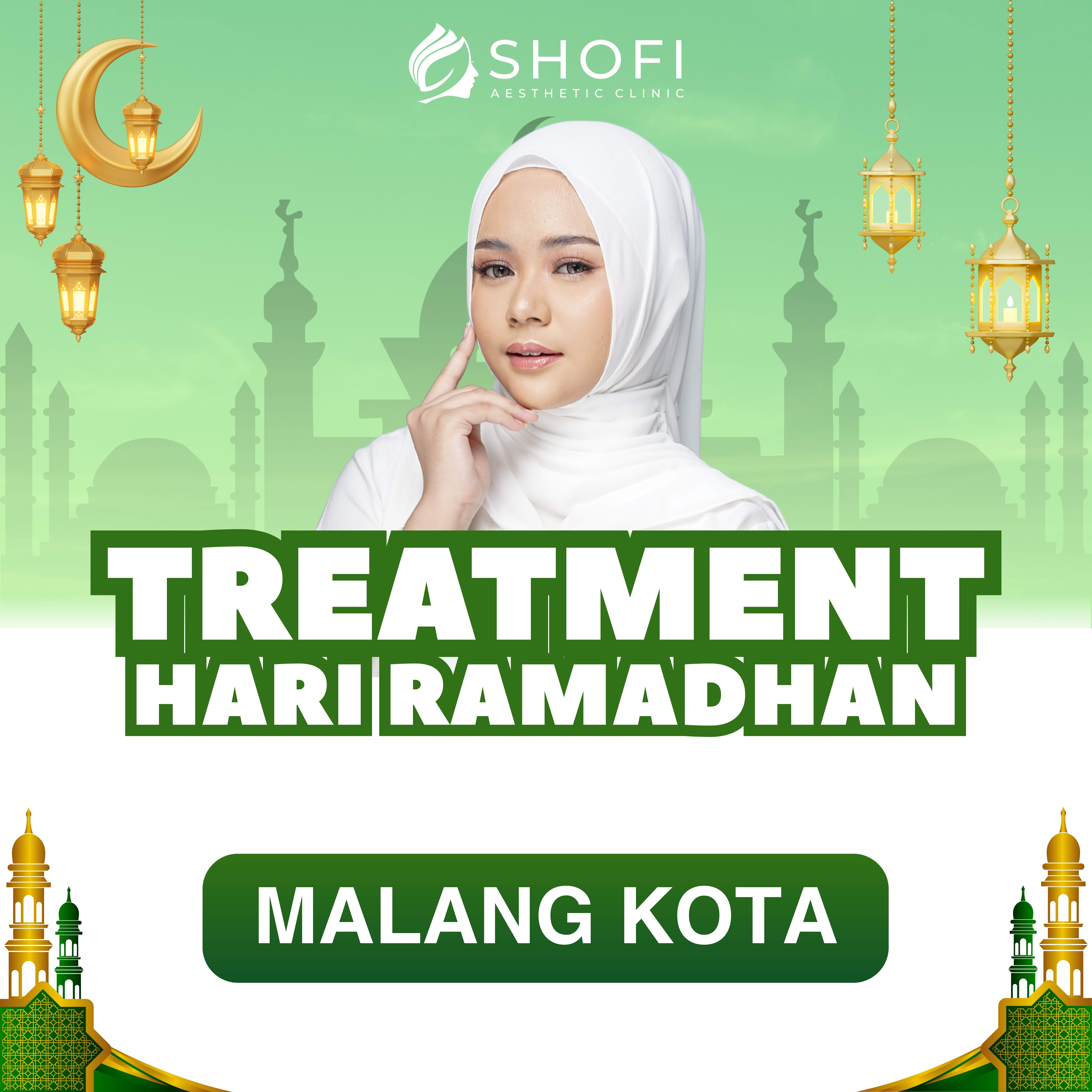 PROMO MARET MALANG KOTA