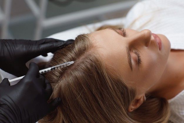 PRP Hair Loss Injection