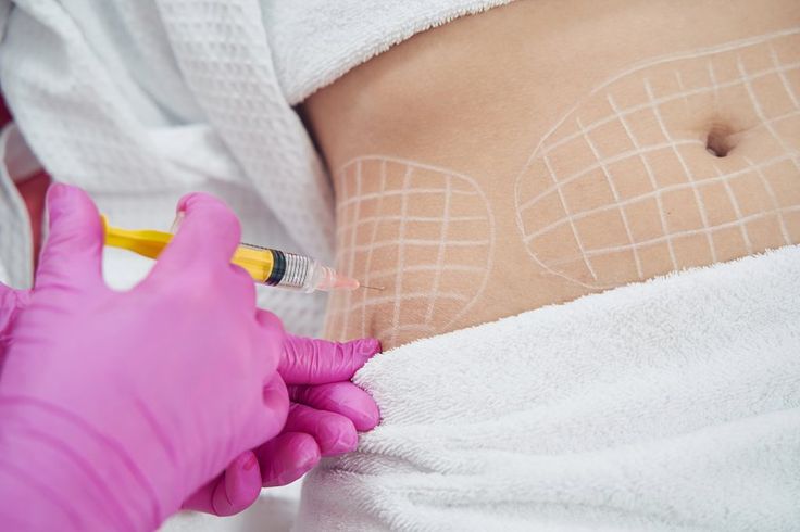 Slimming Injection – Aqualix