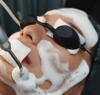 Facial Snow Peel