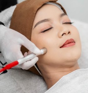 Facial Microdermabrasi + Mesotherapy