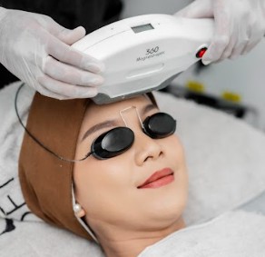 Facial IPL OPT/DPL Whitening