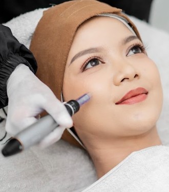 Derma Flek/ Melasma