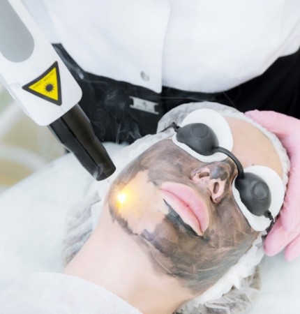 Facial Laser Blackdoll