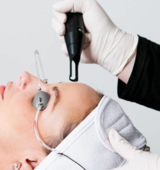 Laser Flek & Melasma