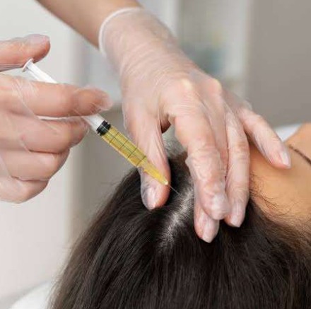 Package PRP Hair Loss