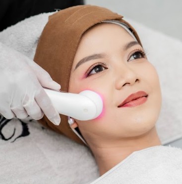 Facial Messotherapy + Chemical Peeling
